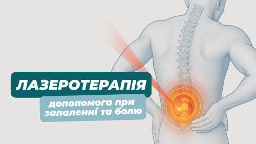 Лазеротерапія: допомога при запаленні та болю Блог - Фото 21