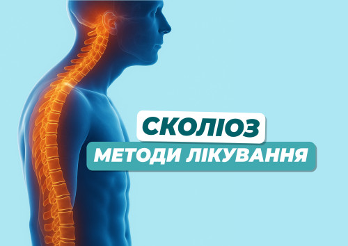Сколіоз у дітей і дорослих Блог - Фото 17